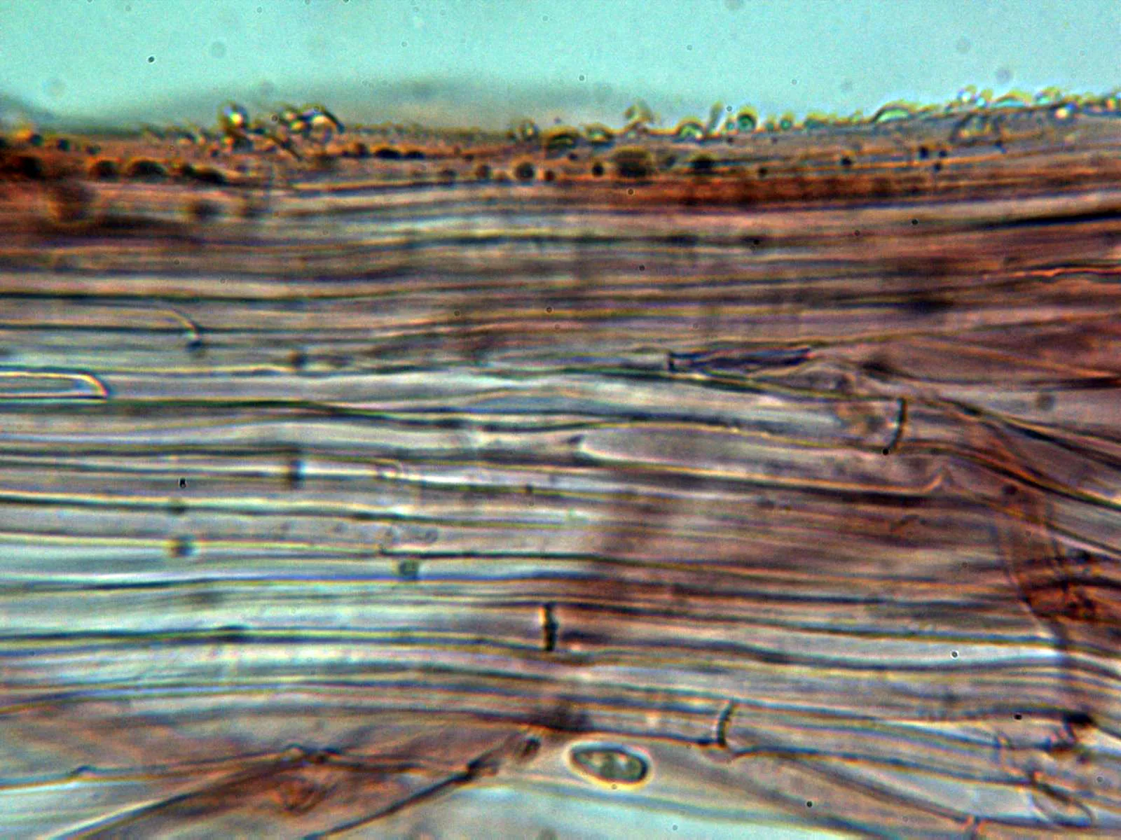 Microscopía de Lepiota cristata - 10 - Hifas estípite sin caulos